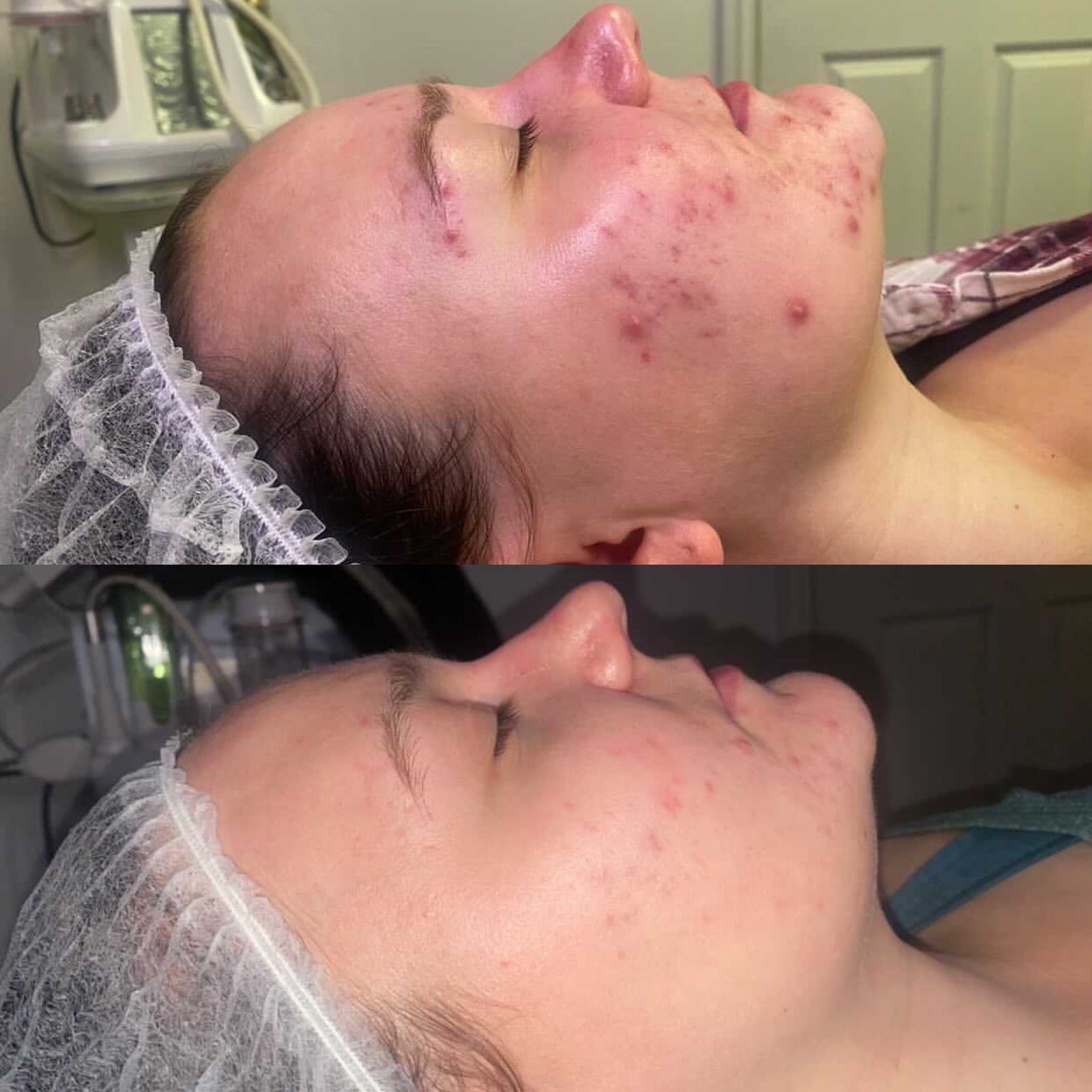 SKINOLOGY x KLARSKIN CLIENT REVIEW