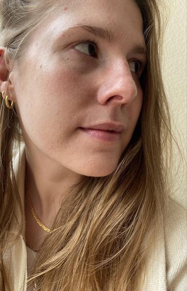 KLARSKIN BEWERTUNG: VALERIA BRÖHL