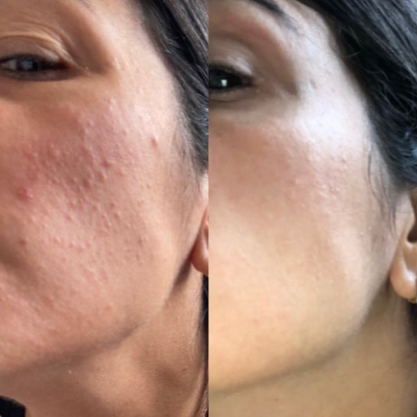 KLARSKIN RADIANCE POWDER REVIEW: ANA LAURA