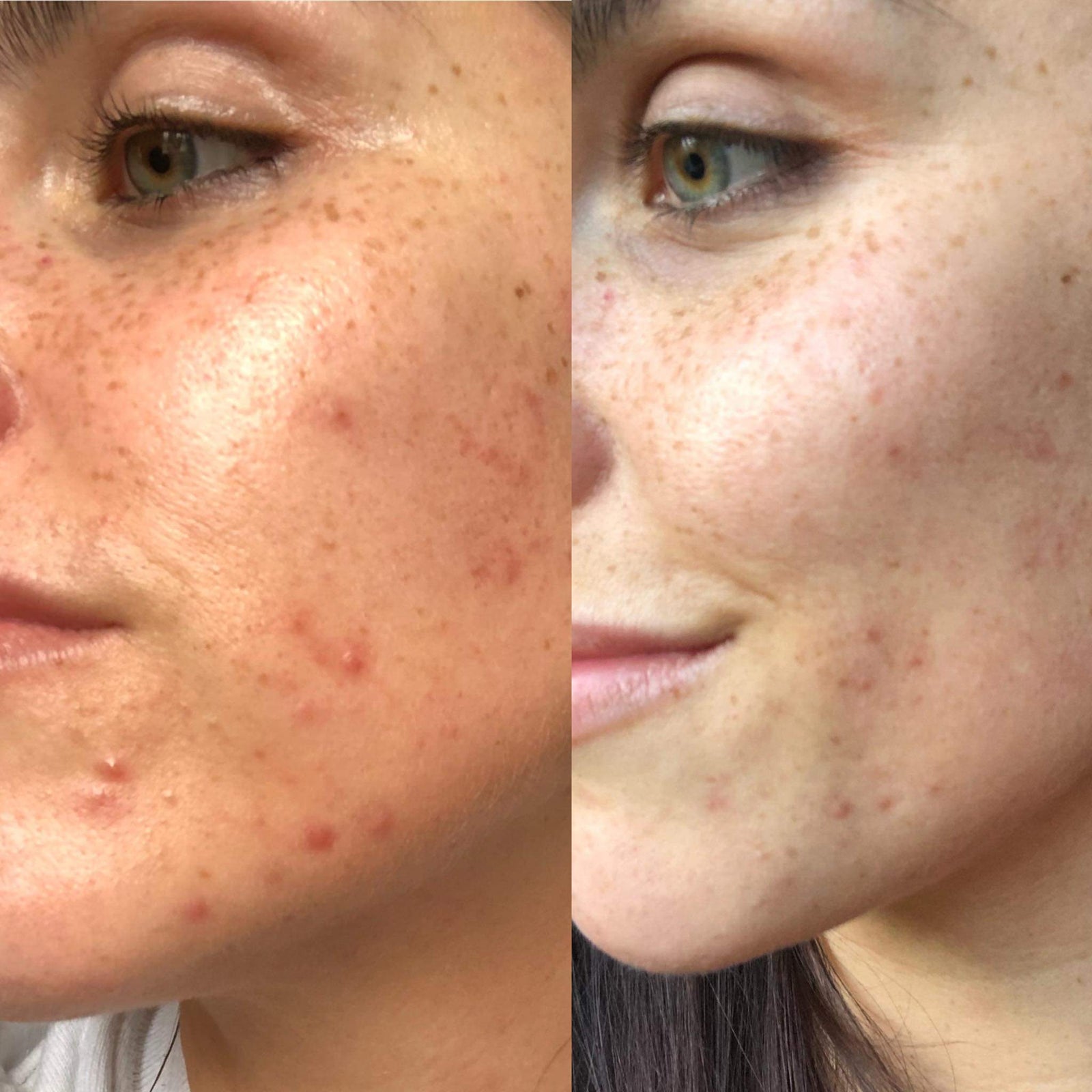 KLARSKIN REVIEW: NICOLE CAMPBELL-WATSON