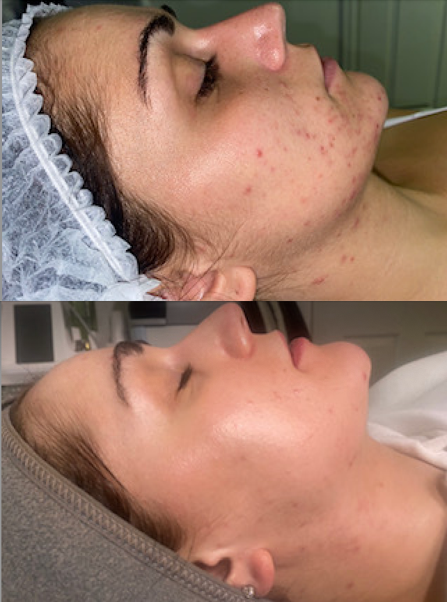 30 DAYS WITH THE RADIANCE POWDER