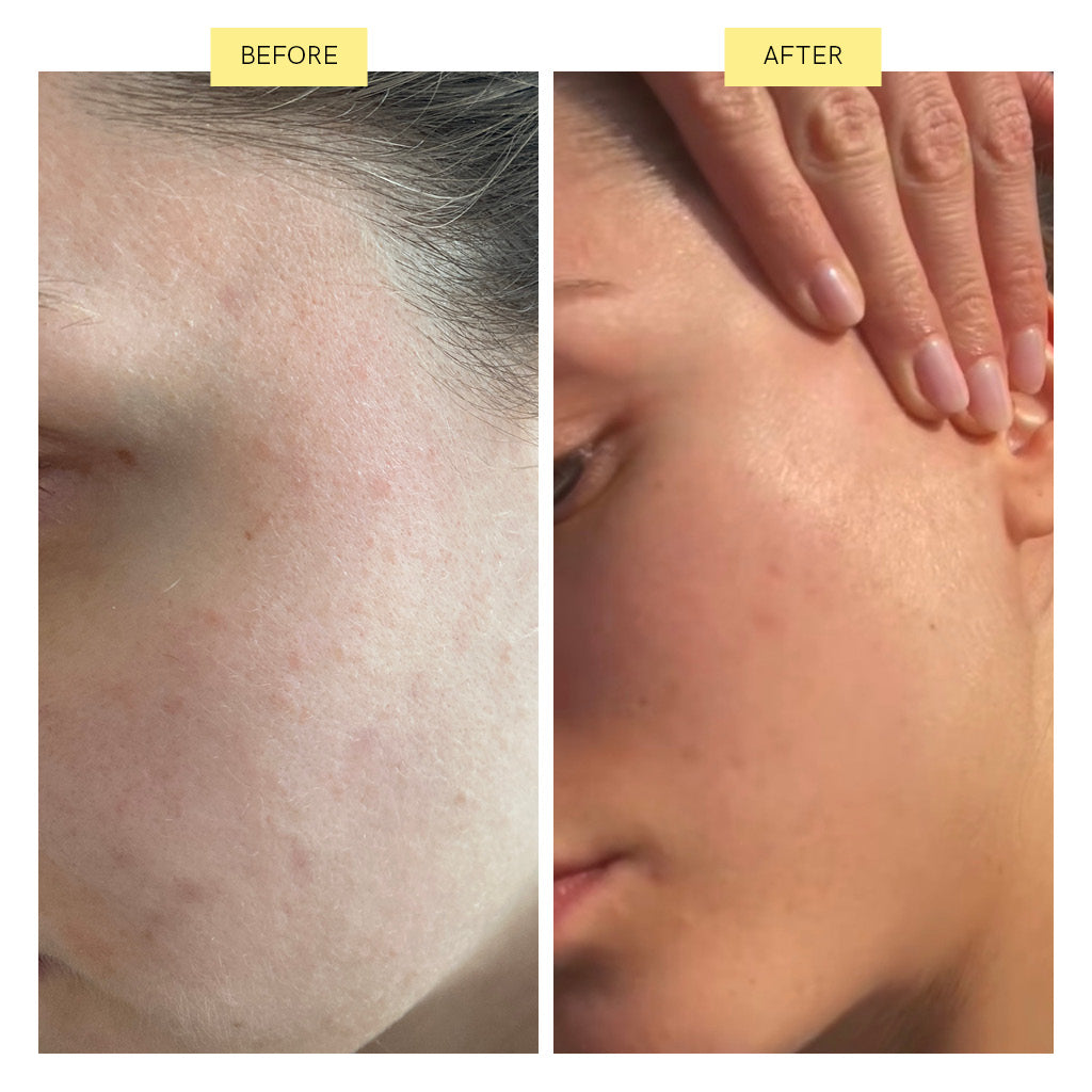 Summer Skin Set: Glowscreen LSF 50 Öl + Radiance Puder