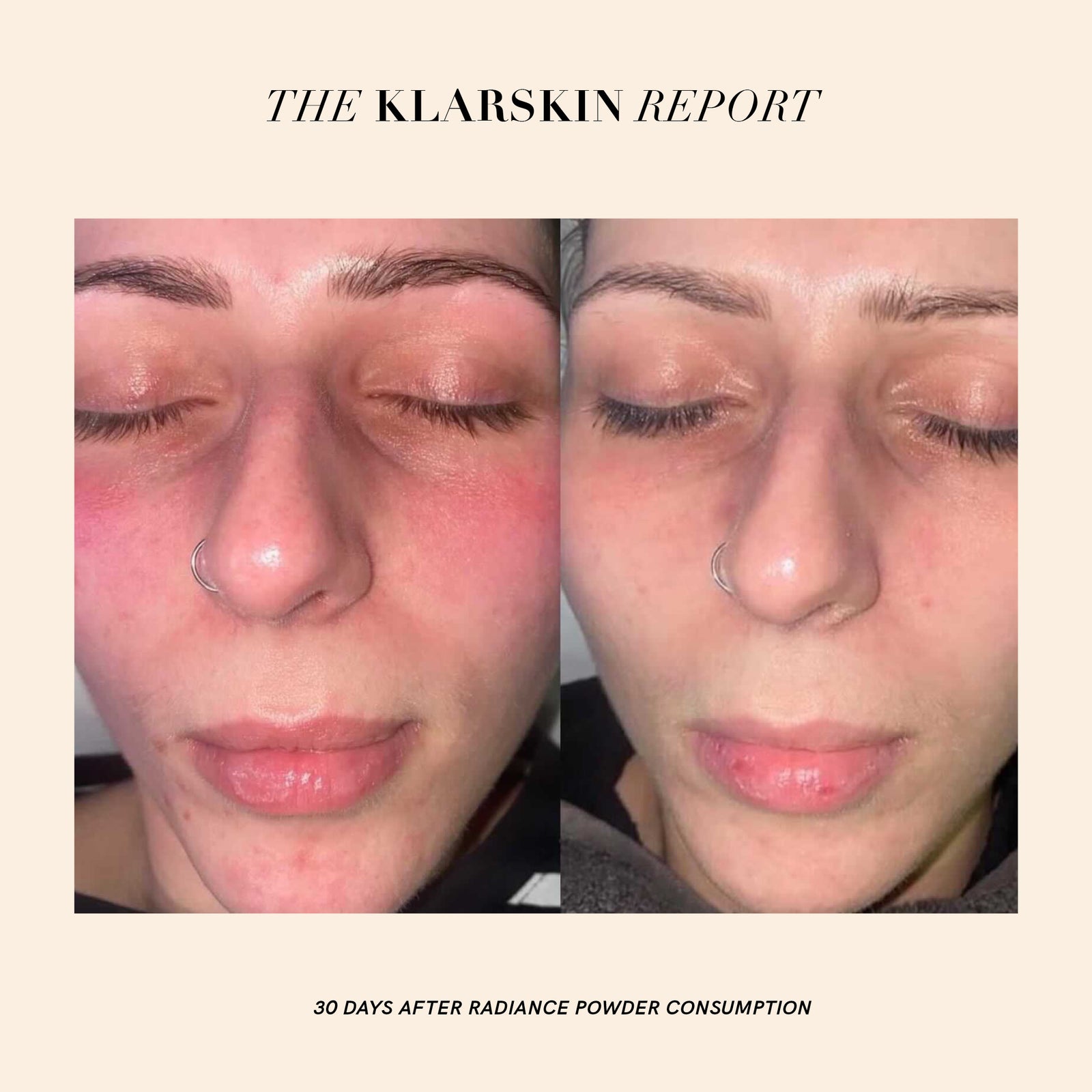 REVIEW: 30 Days with the Radiance Powder